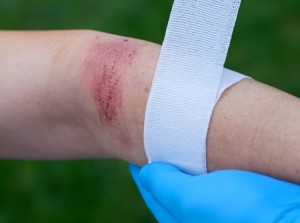 nj-burn-injury-lawyer-anthony-carbone