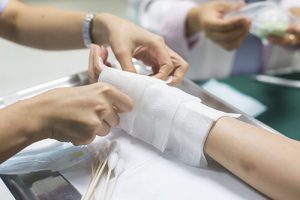 burn injuries anthony carbone