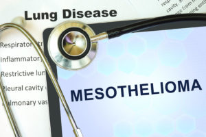 mesothelioma law offices of anthony carbone